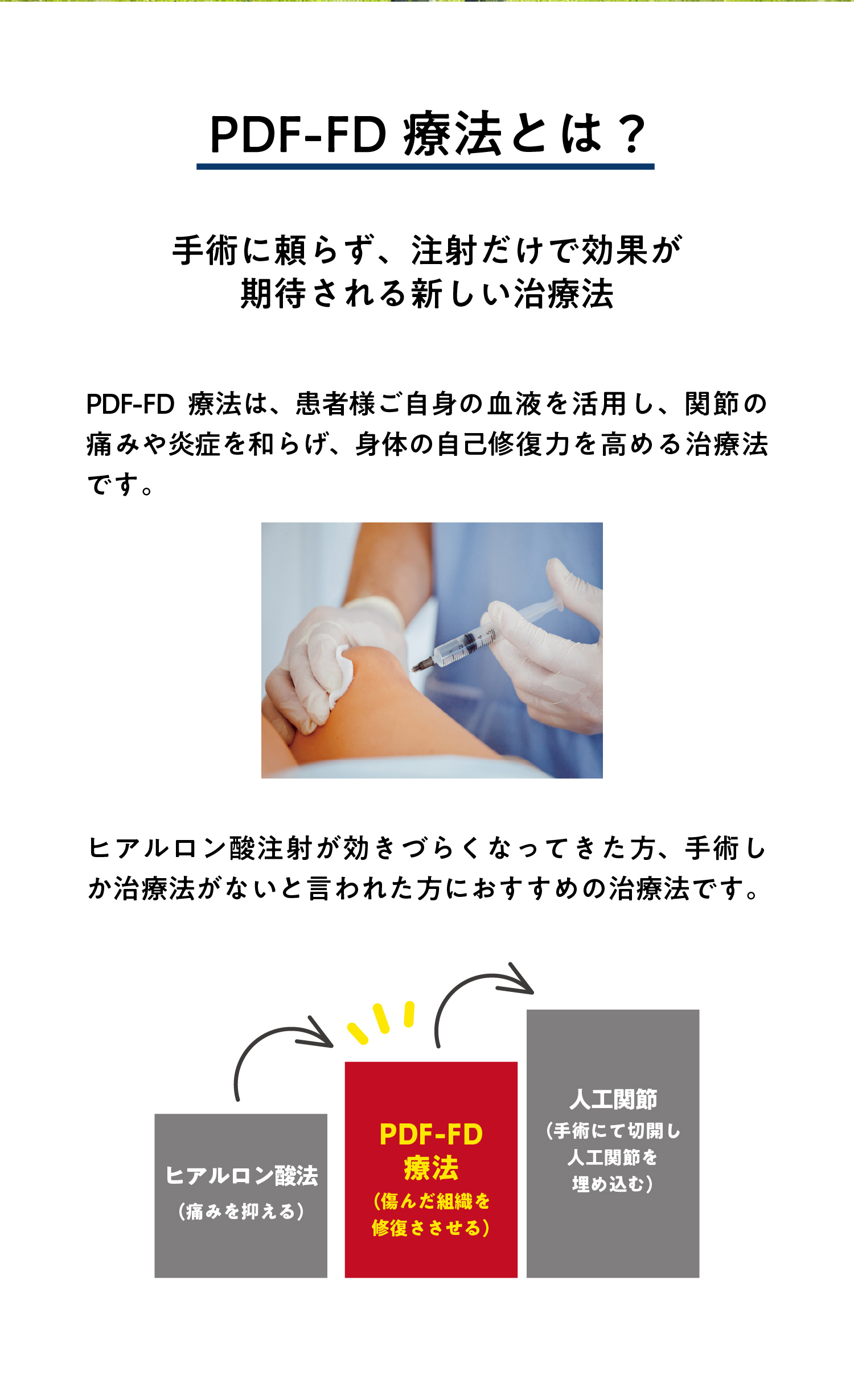 PFC-FD療法とは？