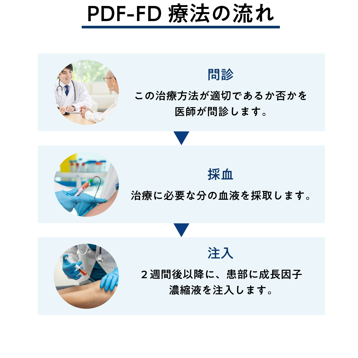 PFC-FD療法の流れ